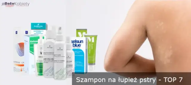 Jakie leki na łupież pstry? 8 skutecznych preparatów i ich działanie