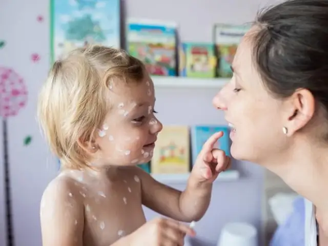 Jak bezpiecznie kąpać dziecko z ospą: sprawdzone porady dla rodziców