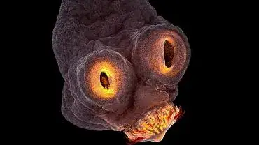 Robaki w jelitach: Jakie badania wykryją pasożyty w Twoim ciele?