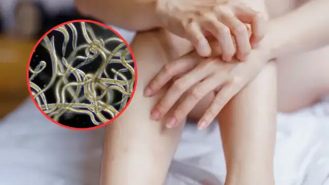 Pasożyty u dzieci: 7 objawów, które przerażają rodziców. Pomoc