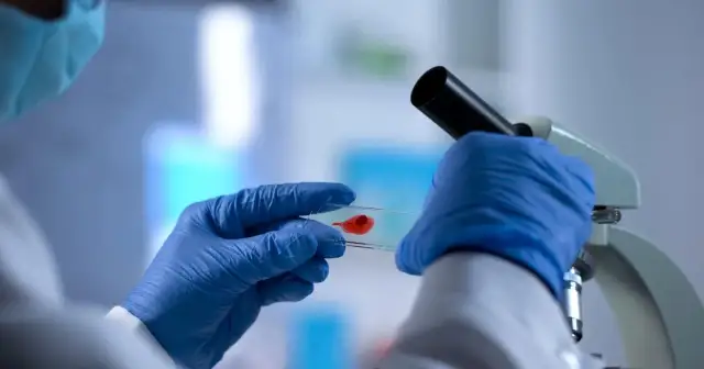 Skąd się wzięło AIDS? Szokująca historia wirusa HIV i jego źródło