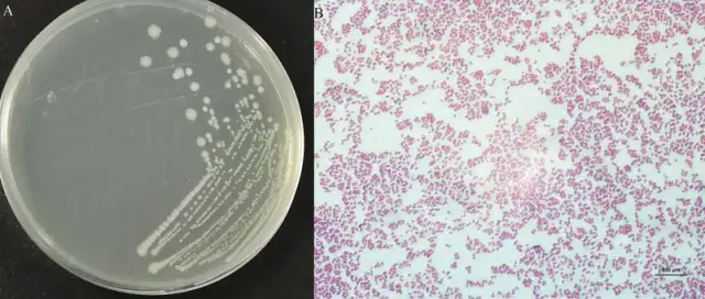 Morganella: objawy i metody leczenia tej niebezpiecznej bakterii.