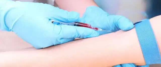 Próby wątrobowe jakie badania: co musisz wiedzieć o ich znaczeniu