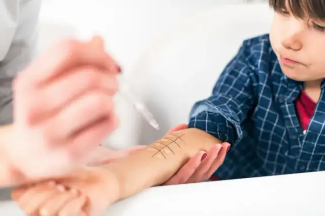 Czy odczulanie na roztocza ma sens? Fakty i wyniki badań klinicznych