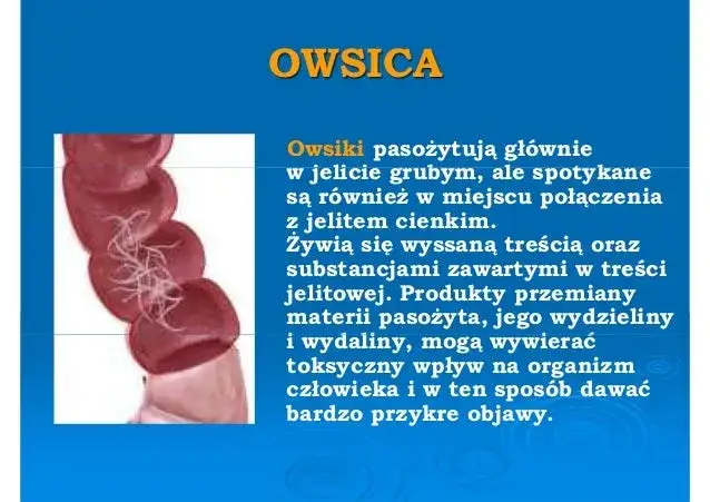 Owsiki a przedszkole: najważniejsze zasady postępowania dla rodziców