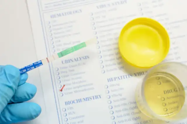 Podwyższony poziom białka w moczu: przyczyny, objawy i zagrożenia zdrowotne