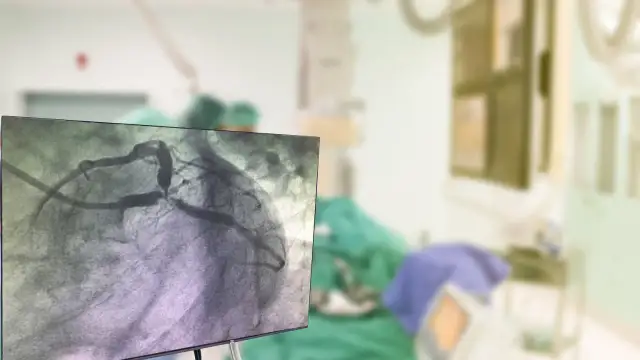 Alkohol po koronarografii: Czy jest bezpieczny dla Twojego serca?