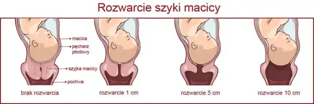 Rozwarcie na 2 palce: ile cm to jest i co oznacza w porodzie?