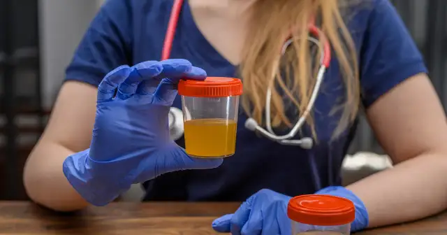 Podwyższony poziom leukocytów w moczu u dziecka – co to oznacza?