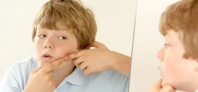 Limpieza facial niños 11 años: Cuida su piel y evita el acné