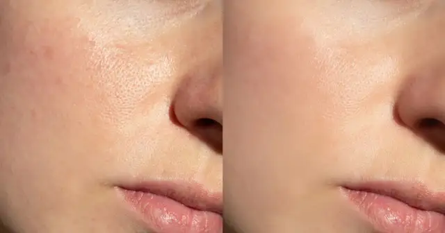 Aplikacja kremu BB: Sekret nieskazitelnej cery bez efektu maski