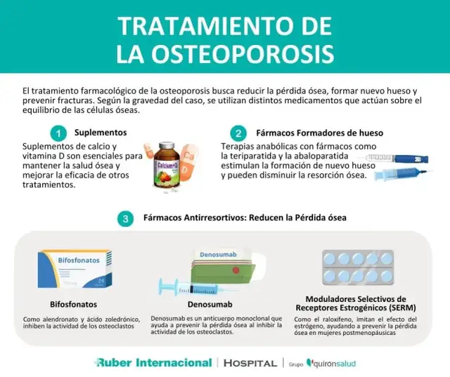 Medicamentos para la osteoporosis: opciones efectivas y riesgos a considerar