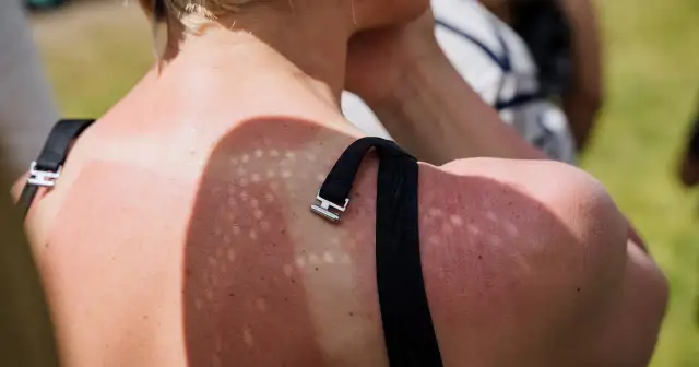 Gaśnica na słońcu? Sprawdź, dlaczego to błąd i jak ją chronić!