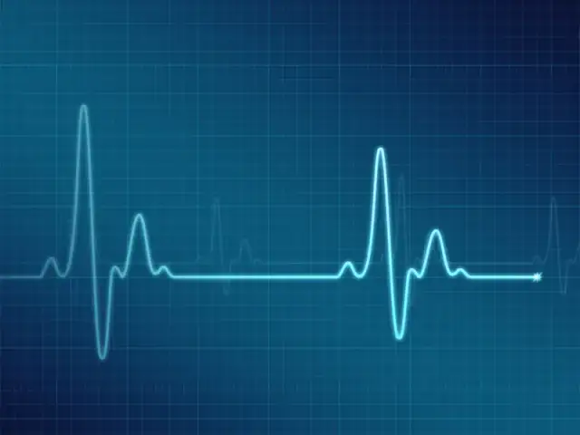 Prawidłowy puls: normy, pomiar i co oznaczają odchylenia