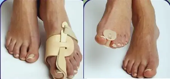 Haluksy: Jaką ortezę wybrać? Ekspert radzi dzień, noc, dynamika.