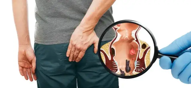 Nie wstydź się! Proktolog: Kiedy iść i jak wygląda wizyta?