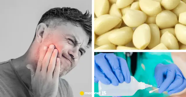 Ból zęba? Natychmiastowa ulga: domowe sposoby i leki OTC