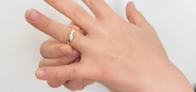 Obrączka utknęła na spuchniętym palcu? 5 domowych sposobów!