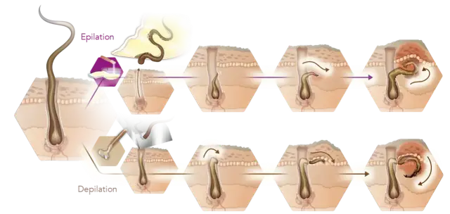 Eingewachsene Haare Intimbereich: Ursachen, Behandlung & Vorbeugung