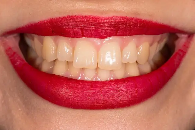 Ile zębów ma człowiek? 20 czy 32? Pełny przewodnik po uzębieniu