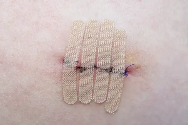 Jaka gaza na rehabilitację? Wybór, który przyspieszy gojenie ran