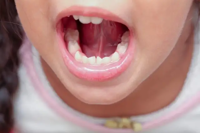 Ile zębów mlecznych ma dziecko? Odkryj ważne fakty o ich rozwoju