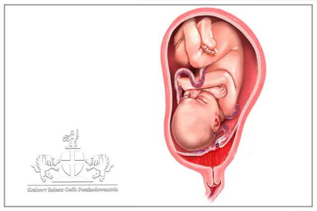 Łożysko w ciąży: Kluczowe funkcje i co grozi dziecku?