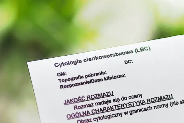 Wynik cytologii cienkowarstwowej (LBC). Dokument porównuje cytologię płynną a zwykłą, oceniając jakość rozmazu.