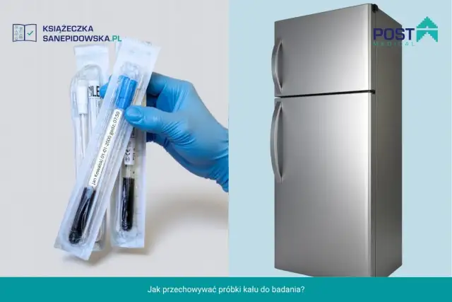 Próbka kału dzień wcześniej? Jak ją przechowywać, by wynik był pewny