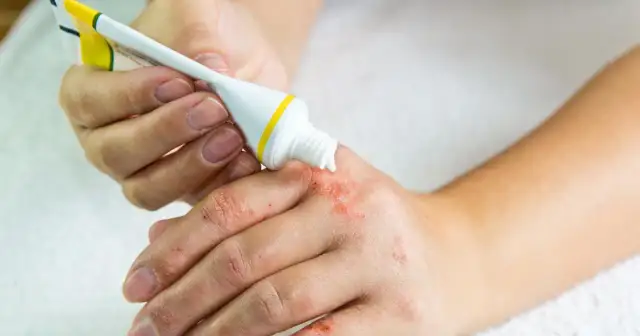 Maść po terminie: groźne skutki! Jak postępować bezpiecznie?