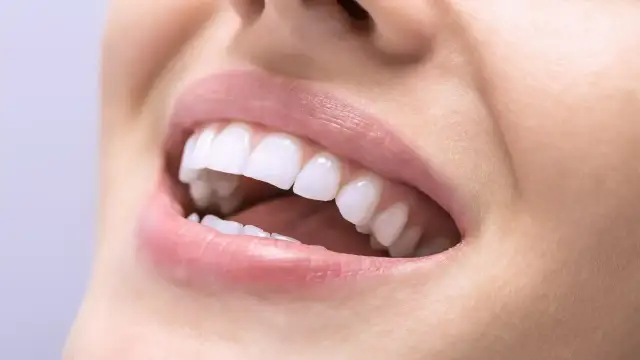 Zbliżenie na uśmiechnięte usta z białymi, zdrowymi zębami.