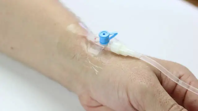 Kroplówka do wenflonu: Instrukcja podłączenia krok po kroku