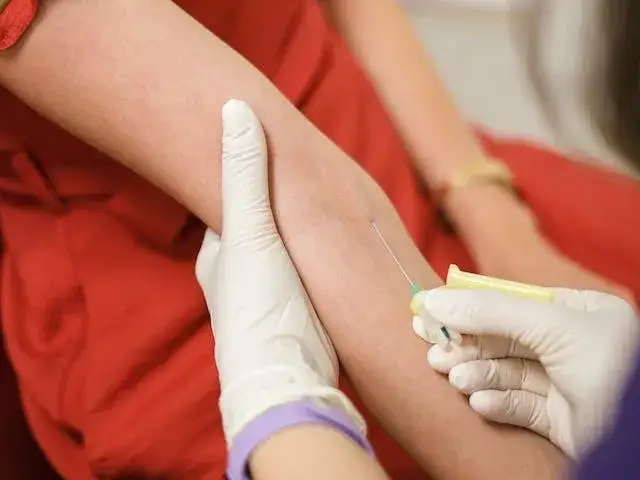 Czy wysoki cholesterol powoduje tycie? Odkryj prawdę o zdrowiu