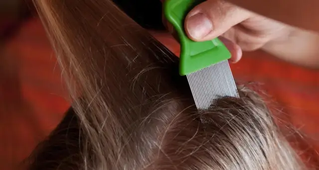 Jak walczyć z wszami u dziecka: skuteczne metody i porady na każdą sytuację