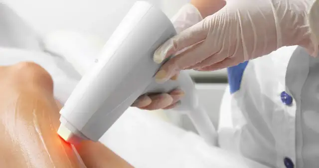 Co ile robi się depilację laserową, aby uzyskać najlepsze efekty?