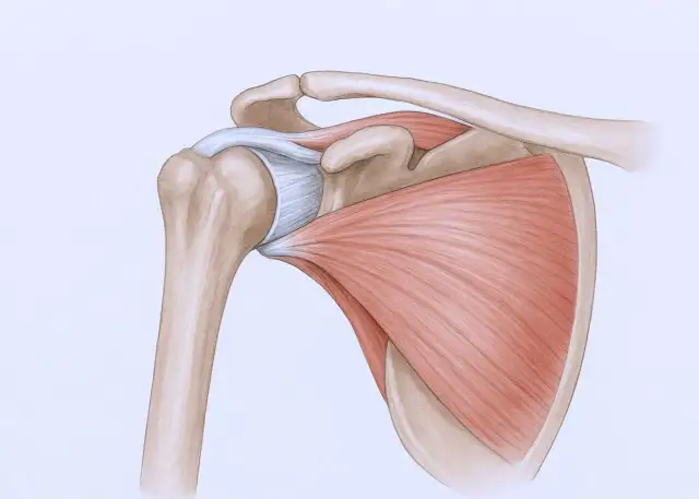 Ból barku przy unoszeniu ręki: Jak sobie pomóc i kiedy do lekarza?