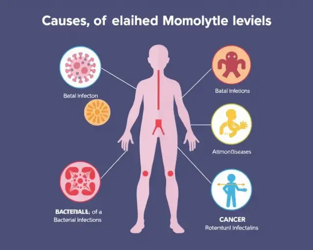 Podwyższone monocyty: Co oznaczają? Przyczyny i kiedy iść do lekarza