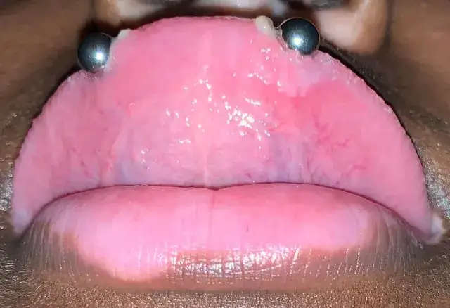 Snake eye piercing co to - wszystko, co musisz wiedzieć przed decyzją