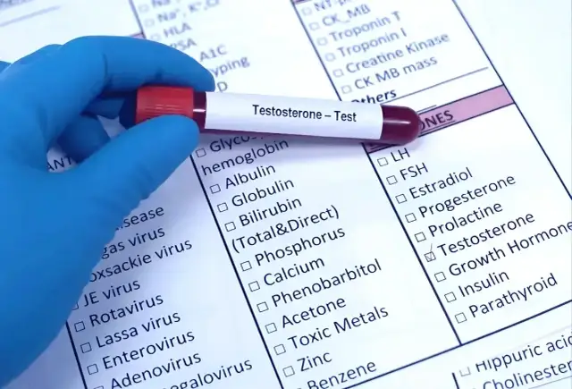 Jak wygląda badanie testosteronu? Co musisz wiedzieć o procedurze