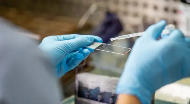 Jak zmniejszyć ryzyko raka? 12 kluczowych zaleceń