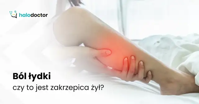 Ból łydek: przyczyny od zmęczenia po zakrzepicę. Kiedy iść do lekarza?