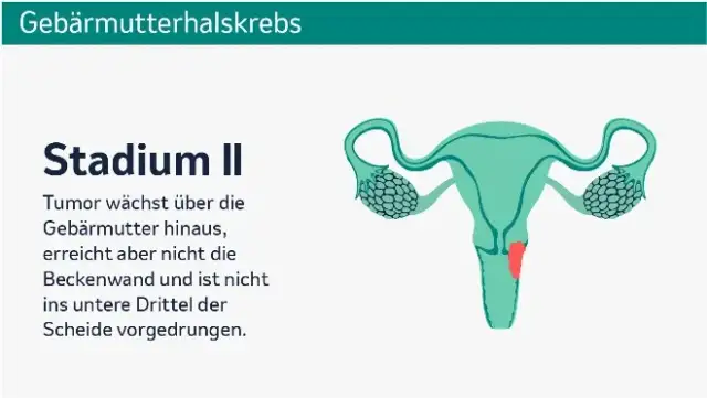 Wichtige Informationen zur Gebärmutterhalskrebs Vorsorge für Frauen