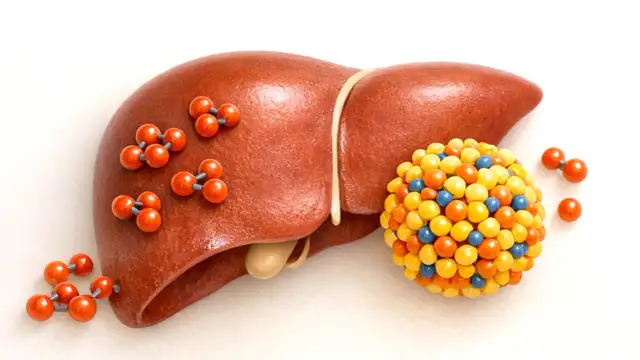 Wątroba z cząsteczkami żelaza, sugerującymi za wysoka ferrytyna. Obok kłębek kolorowych kuleczek.