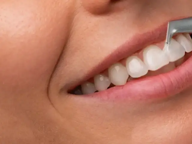 Higienizacja zębów: Ile trwa? Poznaj dokładny czas i czynniki!