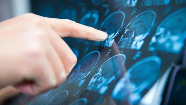 Rezonans magnetyczny: Kreatynina kiedy badanie krwi jest kluczowe?