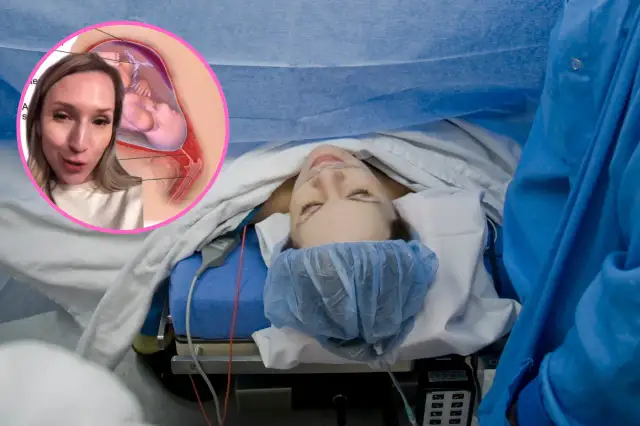 Czwarta cesarka: Bezpieczeństwo i ryzyko. Sprawdź, co radzą lekarze