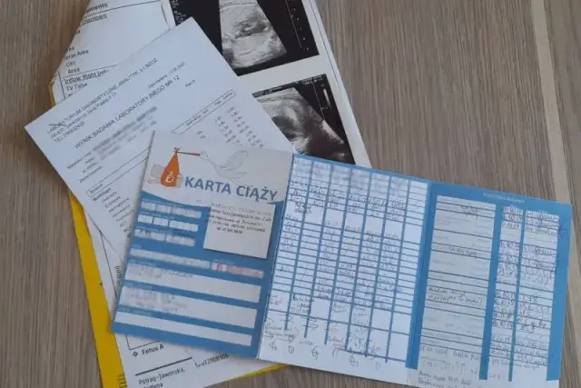 Jak liczyć tygodnie ciąży? Sprawdź, czy znasz złote zasady!