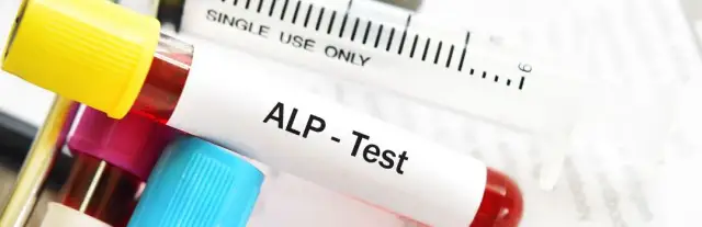 Podwyższona fosfataza alkaliczna: Co oznacza? Przyczyny i kroki