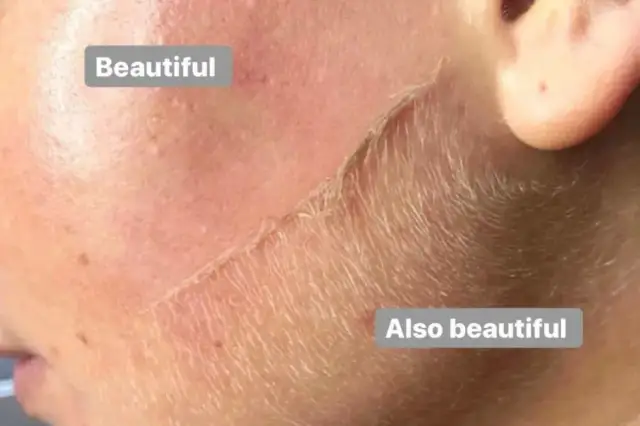 Czy golenie twarzy jest dobre? Odkryj korzyści i ryzyka tej metody