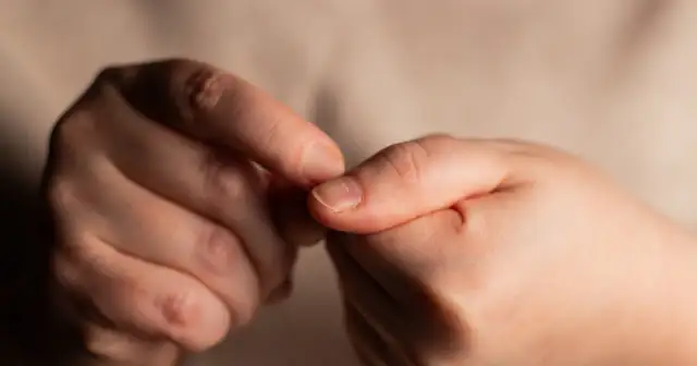 Dłonie z widocznymi, łamliwymi paznokciami, które mogą być jednym z objawów niedoboru białka.